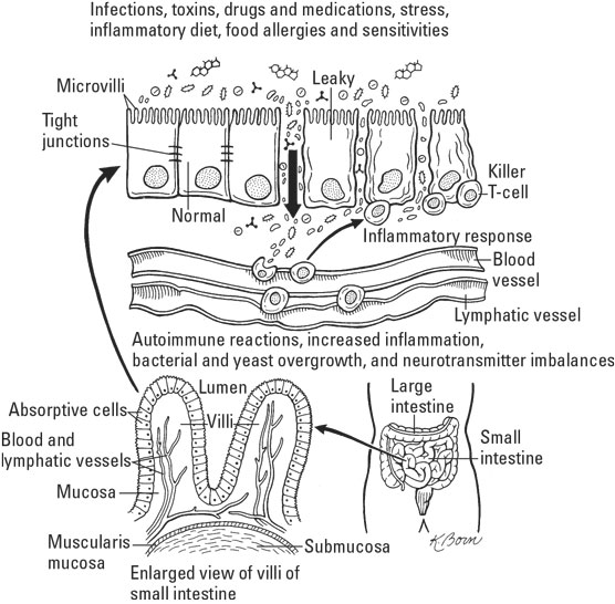 Qu'est-ce que l'inflammation?